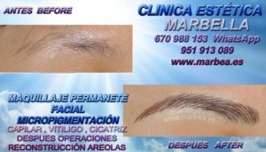 MICROPIGMENTACIÓN MARBELLA CLINICA ESTÉTICA MARBELLA - Los más avanzados tratamientos de maquillaje permanente