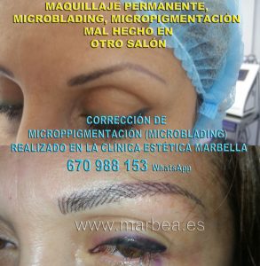 Clinica Estética Marbella siempre con el mejor equipo de MICROPIGMENTACIÓN , microblading y maquillaje permanete Marbaella